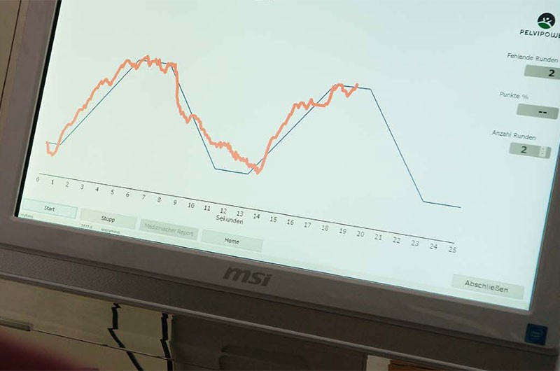 A PelviPower Bio-Feedback-Tréner eredményessége